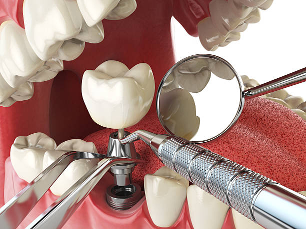 Best Tooth Pain Emergency Relief  in Dutch Island, GA